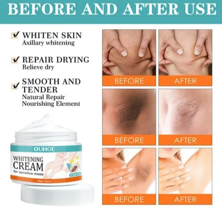 Best Whitening Cream for Private Parts in Pakistan