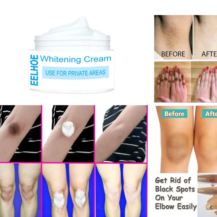 Best Whitening Cream for Private Parts in Pakistan